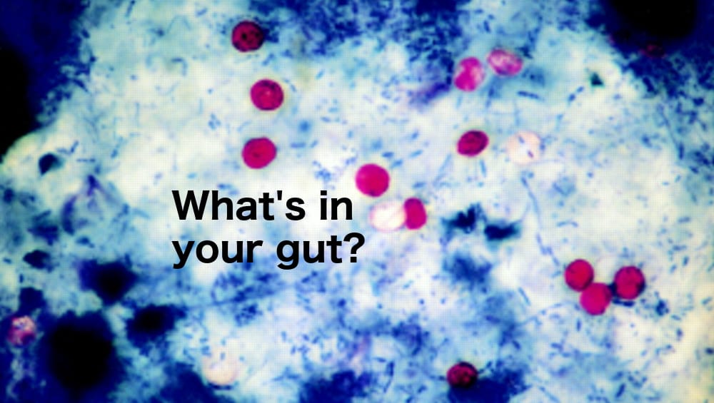 Cyclospora cases surge to nearly 600 in Michigan