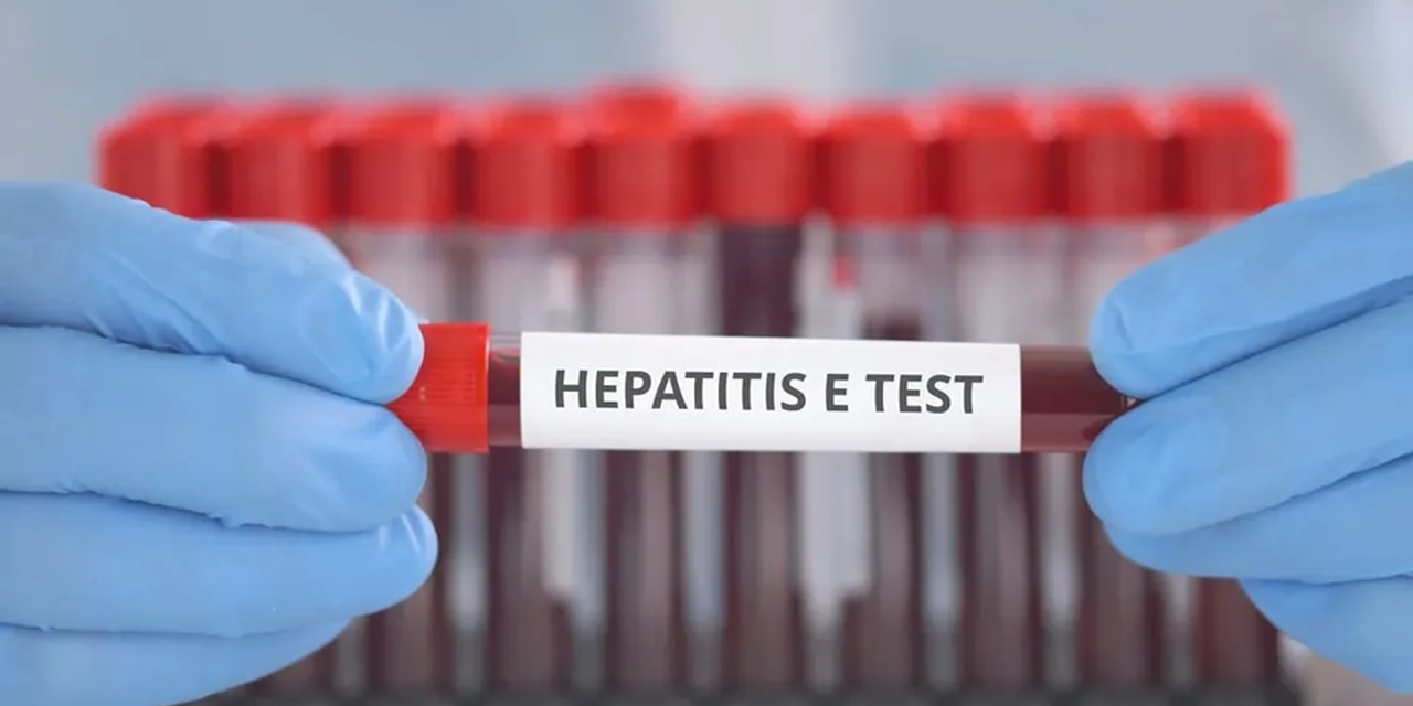 Limited hepatitis E knowledge in pig sector hinders assessment approach